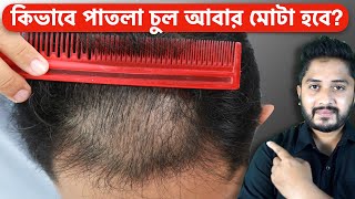 Thin Hair to Thick Hair Naturally  Patla Chul Mota aar Ghono Korar upay [upl. by Weintrob]