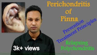 Perichondritis of Pinna Prevention amp Treatment। Difference with Relapsing Polychondritis [upl. by Luane]