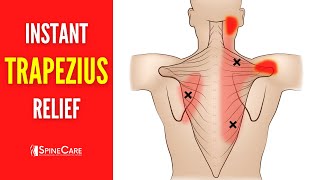 How to Relieve Trapezius Pain FOR GOOD [upl. by Ronile]