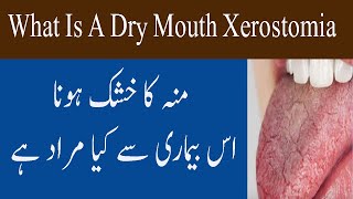 What Is Dry Mouth Xerostomia Condition In Urdu Hindi Muh Khushk Hona Ki Bimari [upl. by Annawd287]