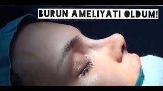 BURUN AMELİYATI OLDUM  EstetikDeviasyon Fotoğraflarla Ameliyat Süreci [upl. by Trah302]