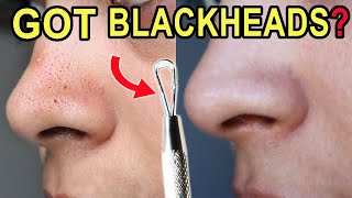 How I Clean Congested Pores on the nose you should have one at home [upl. by Amadus155]