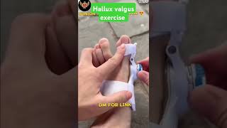 Hallux valgus exercise  Hallux valgus medical solution sorts amry sscgd ssccpo [upl. by Tiana]