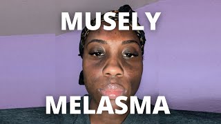 Musely Spot Cream for Melasma Day 1 [upl. by Sandstrom824]