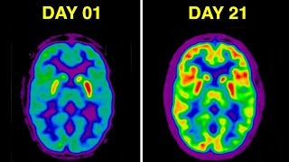 दिमाग को कमज़ोर करने वाली 5 चौकाने वाली आदतें  5 Shocking Brain Damaging Habits [upl. by Attey]