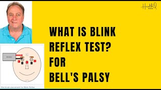 What is Blink reflex test [upl. by Ilan982]