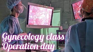 gynecology class are important for 6th yrsurgery dayendometrial cancer [upl. by Che855]