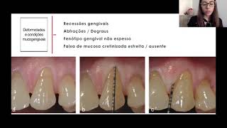 Diagnóstico e Prognóstico das Doenças Periodontais  Parte 2 [upl. by Ecnatsnoc]