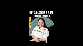 Why 3D Scan is a Must for Dental Implants [upl. by Itsym]