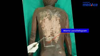 Dissection  Surface Marking Part 1 [upl. by Filmore]