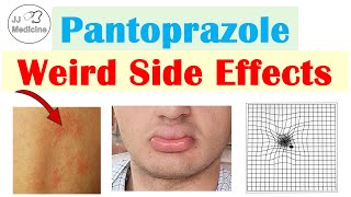 Pantoprazole Weird Side Effects Skin Infections Nutrient Deficiencies amp Why They Occur [upl. by Ashli]