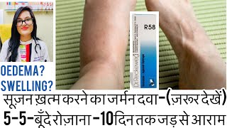 पैरो में सूज़नOedema homeopathic medicinePitting oedemaSwelling treatmentDrrukmani Homeopathy [upl. by Neeli621]