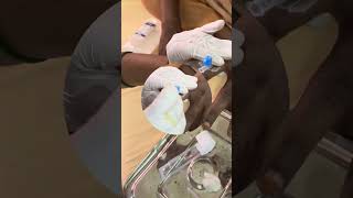 Lets see how to administer IV cannulation on the index finger nurses youtubevideo doctor neet [upl. by Esej845]