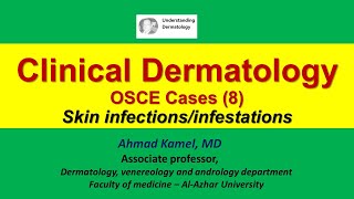 Clinical Dermatology OSCE Cases 8 Skin Infections and Infestations [upl. by Medarda]