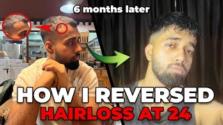 How to stop Hair loss amp Regrow your hairs in 6 Months [upl. by Traweek454]