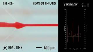 Microfluidic blood flow behaviour with hydrodynamic focusing using Elveflow OB1 pressure controller [upl. by Aryl]