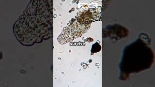 Tardigrades Water Bears The Indestructible Micro Creatures IndestructibleLife MicroCreatures [upl. by Gratianna]