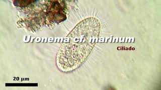 Uronema cf marinum Ciliophora [upl. by Osicnarf]