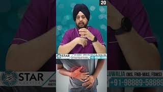 Hiatus Hernia Symptoms In Hindi  Hiatal Hernia Hone Ke Karan Symptoms [upl. by Lednik412]