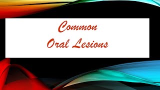 Common Oral Lesions  Definitions [upl. by Ammadas]