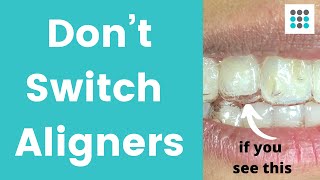 DON’T SWITCH ALIGNERS IF YOUR TEETH ARE NOT TRACKING l Dr Melissa Bailey Orthodontist [upl. by Flynn]