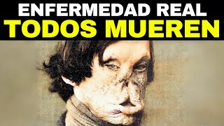 Las 12 Enfermedades Más Terribles De La Historia [upl. by Ahsel544]