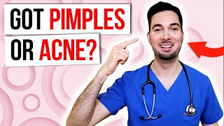 How to get rid of pimples overnight and acne [upl. by Oicinoid]