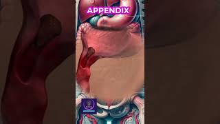 Appendix Inflammation Overview shorts [upl. by Annayram]