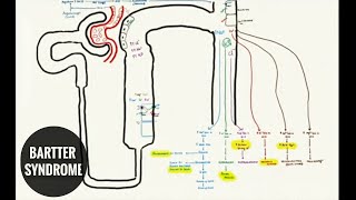 BARTTER SYNDROME and LOOP DIURETICS [upl. by Femi]