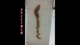 Balanoglossus 🪱  Hemichordata  NonChordata  Specimen [upl. by Lam]