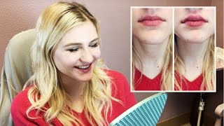 1 Syringe of Juvederm Lip Injections from Doctor Cynthia Cote [upl. by Morton]