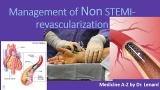 Management of Non STEMI Timing for PCI Anticoagulation antiplatelet UN VS NSTEMI [upl. by Enywad]