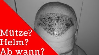 Haartransplantation Erfahrung  Kopfbedeckung  ab wann wieder Mütze oder Helm tragen [upl. by Sorac]