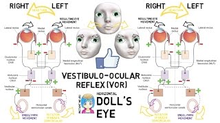 INSTANT NEURO  Dolls Eye [upl. by Ahsyen90]