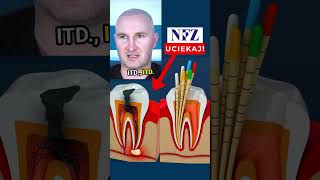 😱Leczenie🦷 na NFZ😳 leczeniekanałowe nfz dentystaopole stomatologopole mikrostomart [upl. by Alvord]