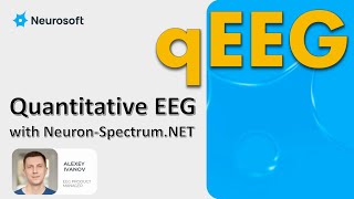 Quantitative EEG qEEG with NeuronSpectrumNET [upl. by Aisatna]