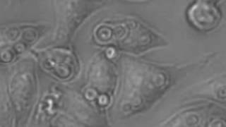 Cryptococcus neoformans migrating between macrophages [upl. by Rafiq715]