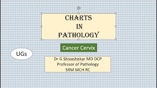 ChartCANCER CERVIX Pathology RATS MBBS SRM Dr GSS University Exam [upl. by Adnal]