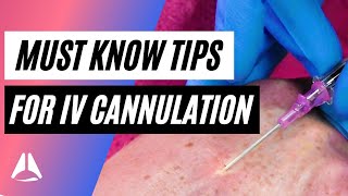 Important tips and tricks for IV cannulation [upl. by Aerdnael]