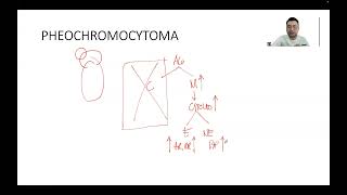 ENDOCRINE PHEOCHROMOCYTOMA [upl. by Stockton211]