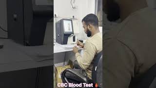 CBC Blood Test [upl. by Hamnet]