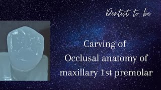 how to carve occlusal anatomy of maxillary 1st premolar [upl. by Aisnetroh442]