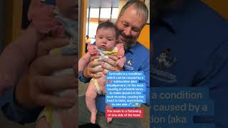 Torticollis in infants can be treated by pediactric Chiropractors torticollis baby infant [upl. by Ehtiaf]