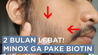 Progres Minoxidil 2 Bulan Tanpa Biotin [upl. by Le]