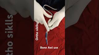 Bone Awlsurgical instrument in hindiBone awl use nail may kya kam atahshortvideo trandingvideo [upl. by Karlyn]