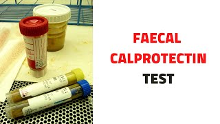 FECAL STOOL CALPROTECTIN TEST Uses Inflammatory Bowel Disease [upl. by Fianna]