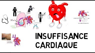 insuffisance cardiaque de A à Z [upl. by Hammerskjold]