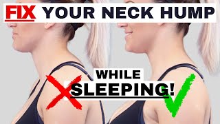 BEST sleeping position to FIX Neck Hump Hunchback or Forward Head Posture  Dr Jon Saunders [upl. by Otrebogad712]