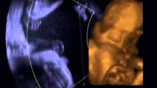 Ultrasound images of baby at 29 weeks [upl. by Atinihs540]