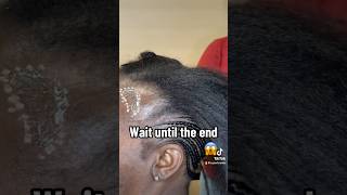 This is how you fix bald areas with braids ‼️ [upl. by Maria]